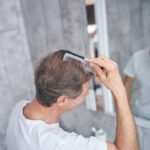 Tratamientos anticaida mas efectivos