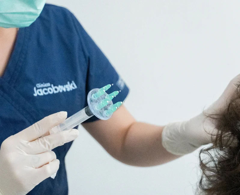 Mesoterapia Capilar Barcelona