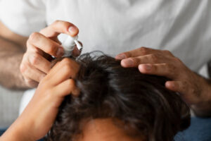 tratamiento minoxidil
