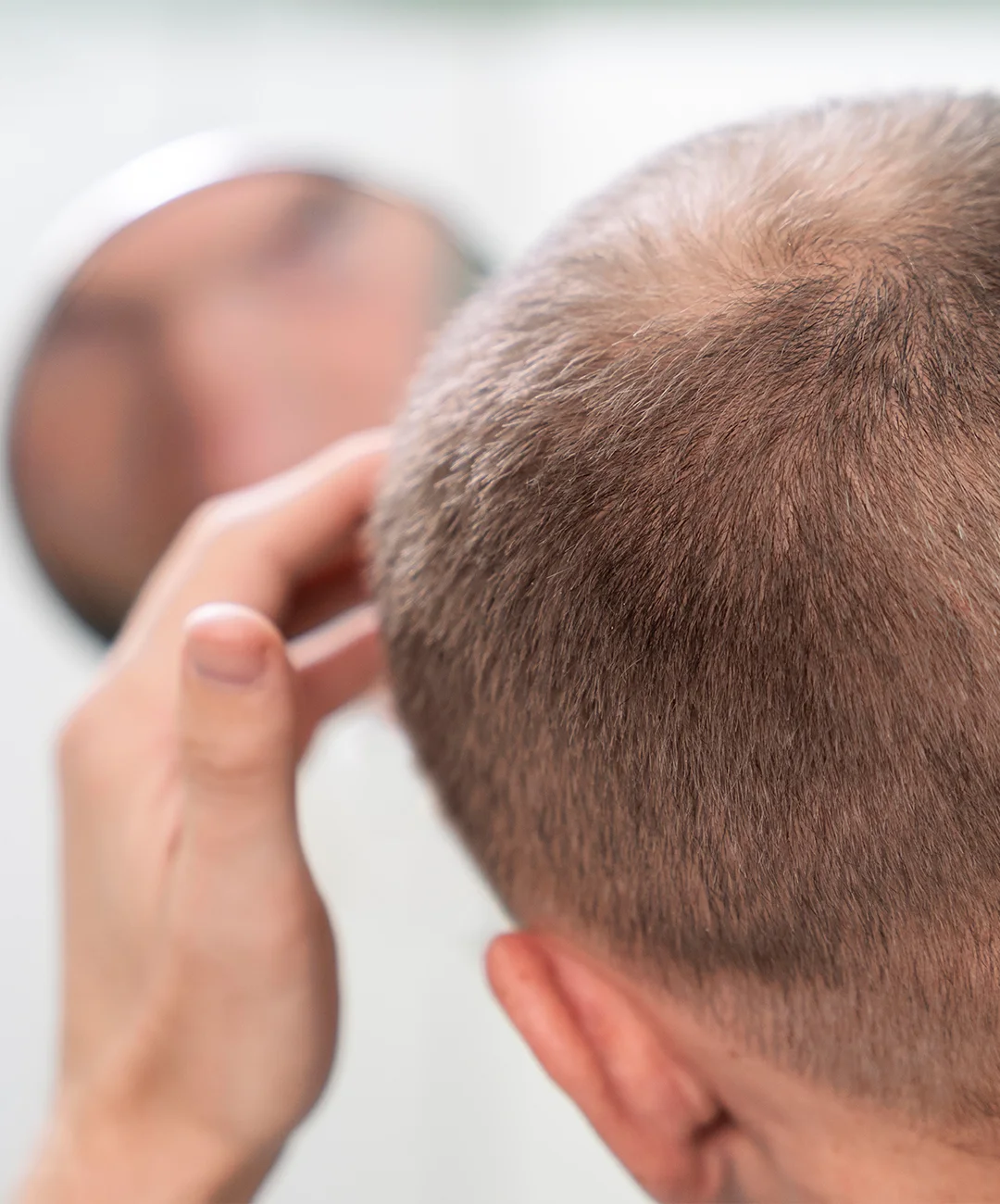 tratamientos capilares tratamientos capilares