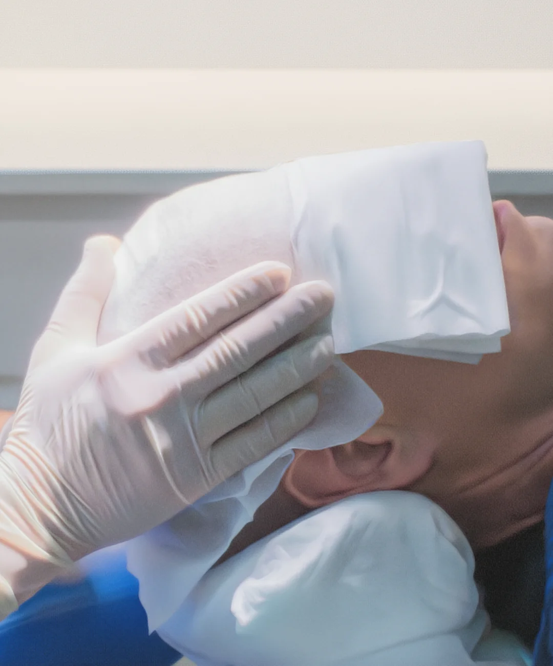 Injerto capilar entradas Barcelona Injerto capilar entradas Barcelona