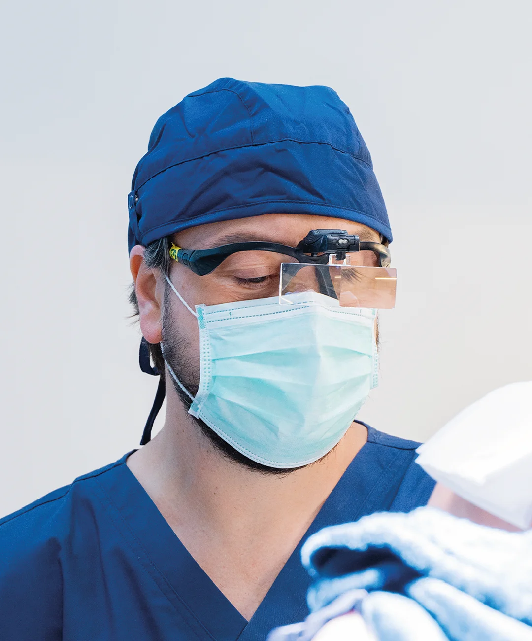 injerto de barba injerto de barba