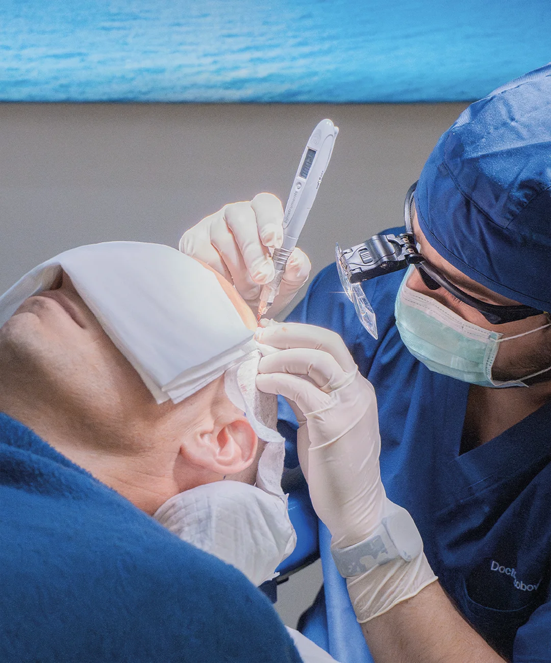 Microinjerto capilar