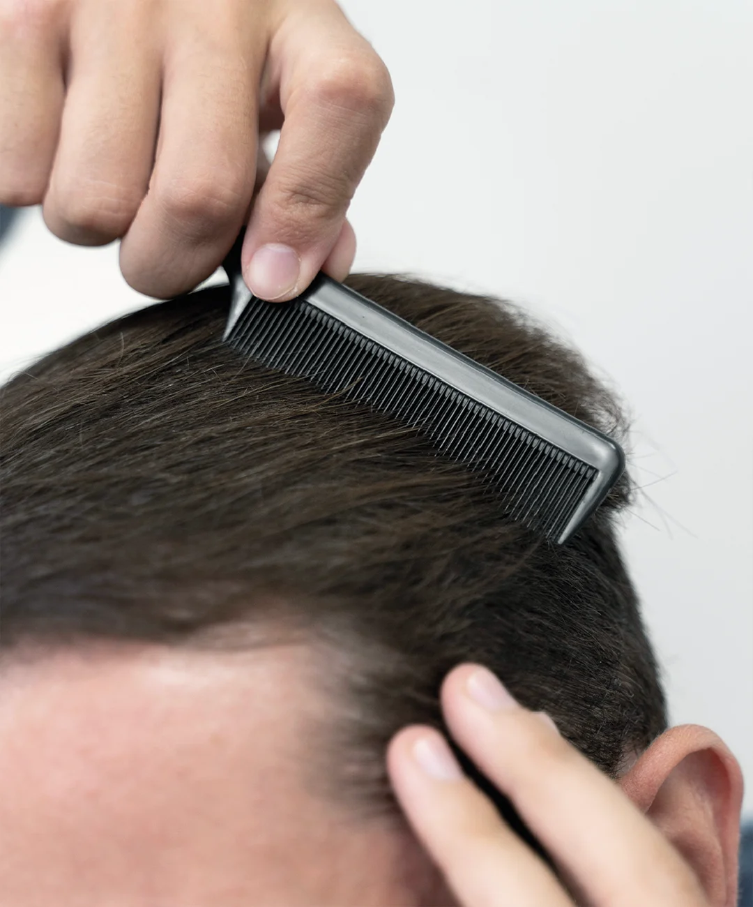 Microinjerto capilar