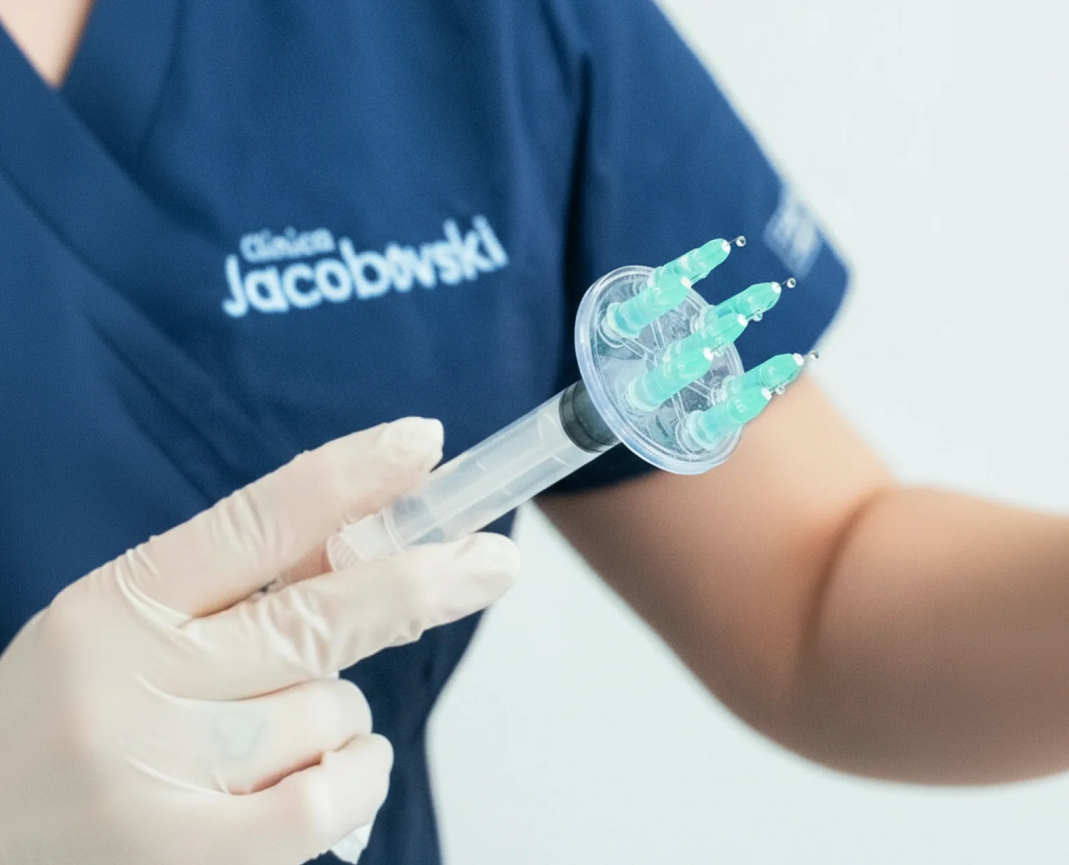 PRP Capilar PRP Capilar