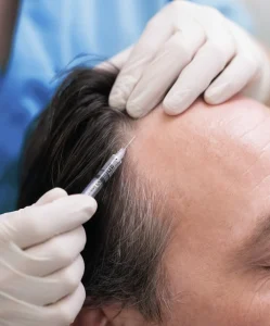 tratamientos capilares