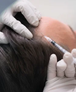 Técnica fue avanzada