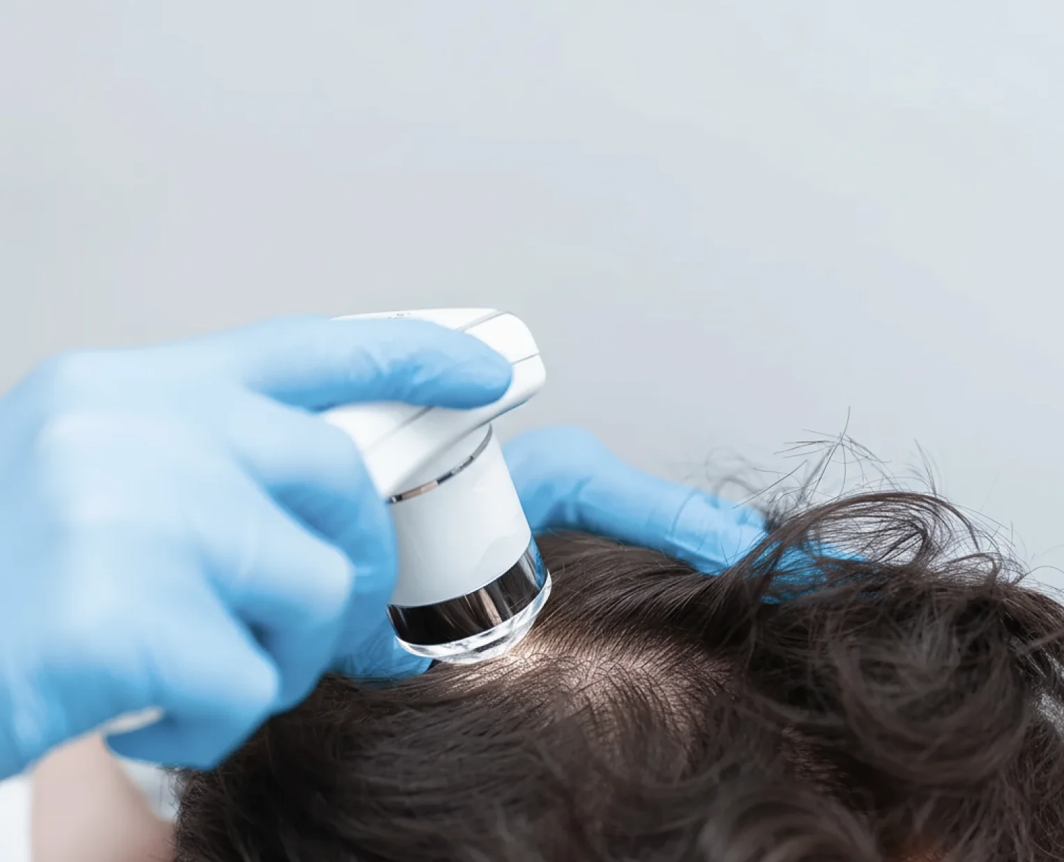 Tratamientos Anticaída Tratamientos Anticaída