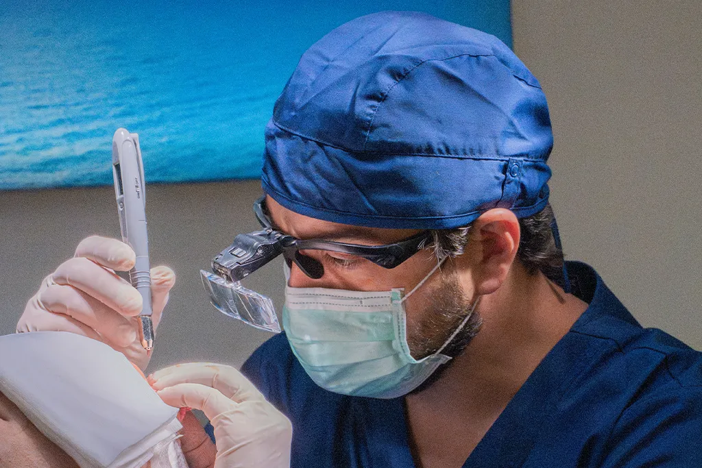 resultados injerto capilar a los 10 años