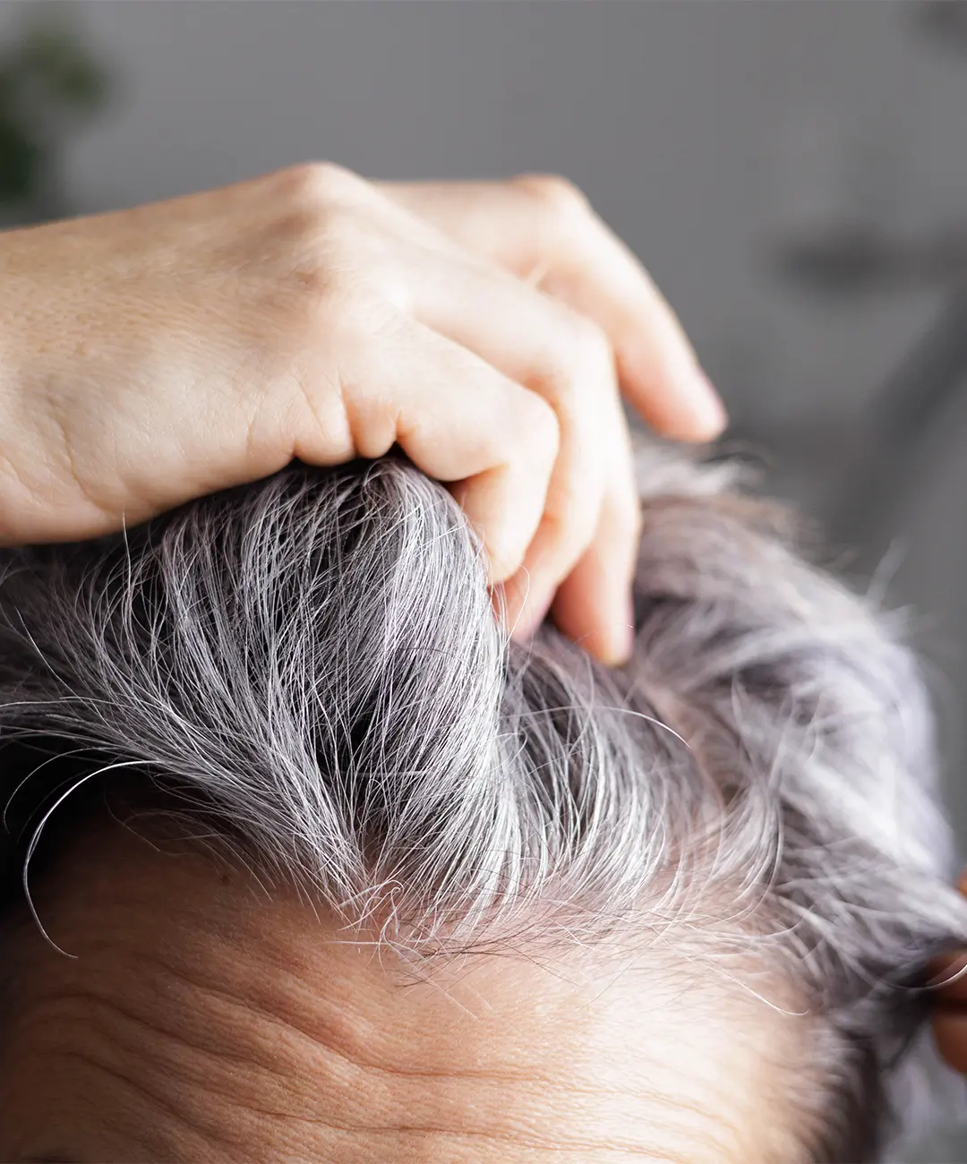 Injerto Canas Barcelona Injerto Canas Barcelona