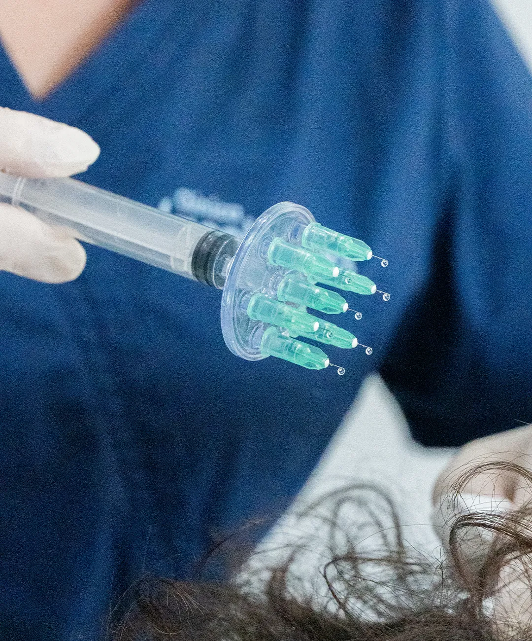 problemas de tiroides y la caída del cabello problemas de tiroides y la caída del cabello