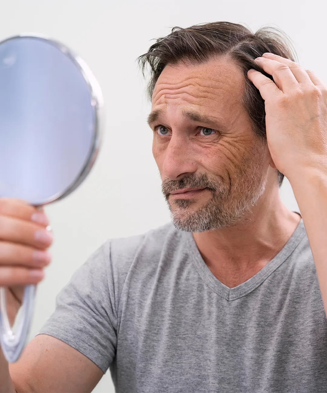 problemas de tiroides y la caída del cabello problemas de tiroides y la caída del cabello